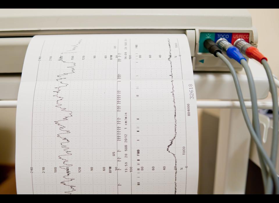 Dr. Adelman suggests vacationers take with them a list of all of their medications and medical conditions. "Bring a copy of your EKG  if you have a heart condition," Dr. Adelman said, adding that if you suffer a chest ailment, the data will be helpful for doctors to make comparisons. "Ask for essential copies of tests. If you were hospitalized, obtain a report of what that involved. It's nice to have the most updated information."  