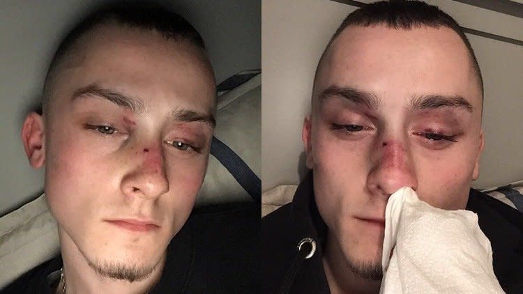 Victim of homophobic attack