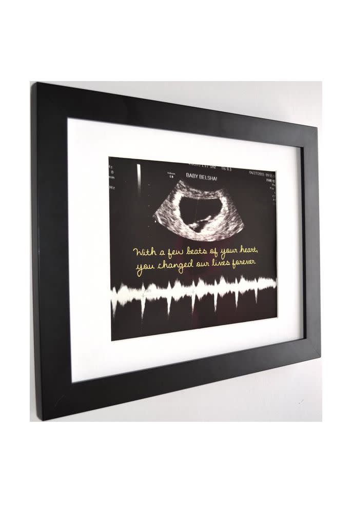 Custom Sonogram Frame