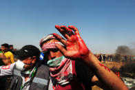 <p>Palestinians carry a wounded demonstrator during clashes with Israeli security forces following a protest on the Gaza-Israel border east of the Jabalia refugee camp in the northern Gaza Strip on April 6, 2018. The Gaza border with Israel has been enflamed by violence since Israeli forces opened fire on a protest march on March 30, killing 19 Palestinian (Photo: Momen Faiz/NurPhoto via Getty Images) </p>