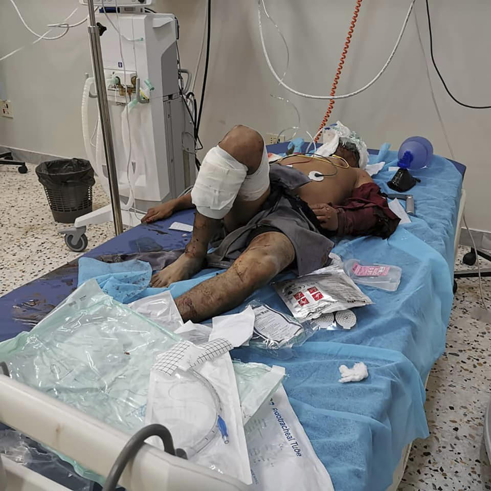 A man injured in an airstrike that hit a biscuit factory is treated in a hospital in the capital, Tripoli, Libya, Monday, Nov. 18, 2019. Tripoli has been the scene of fighting since April between the self-styled Libyan National Army and an array of militias loosely allied with the U.N.-supported but weak government which holds the capital. (Center for Field Medicine and Support via AP)