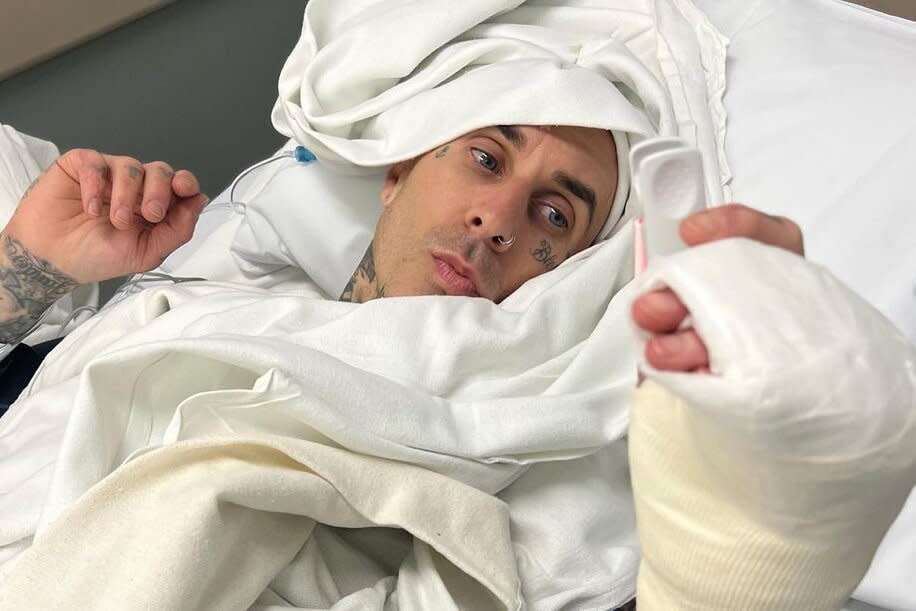 Travis Barker Says It was a 'Hard Decision' to get Finger Surgery