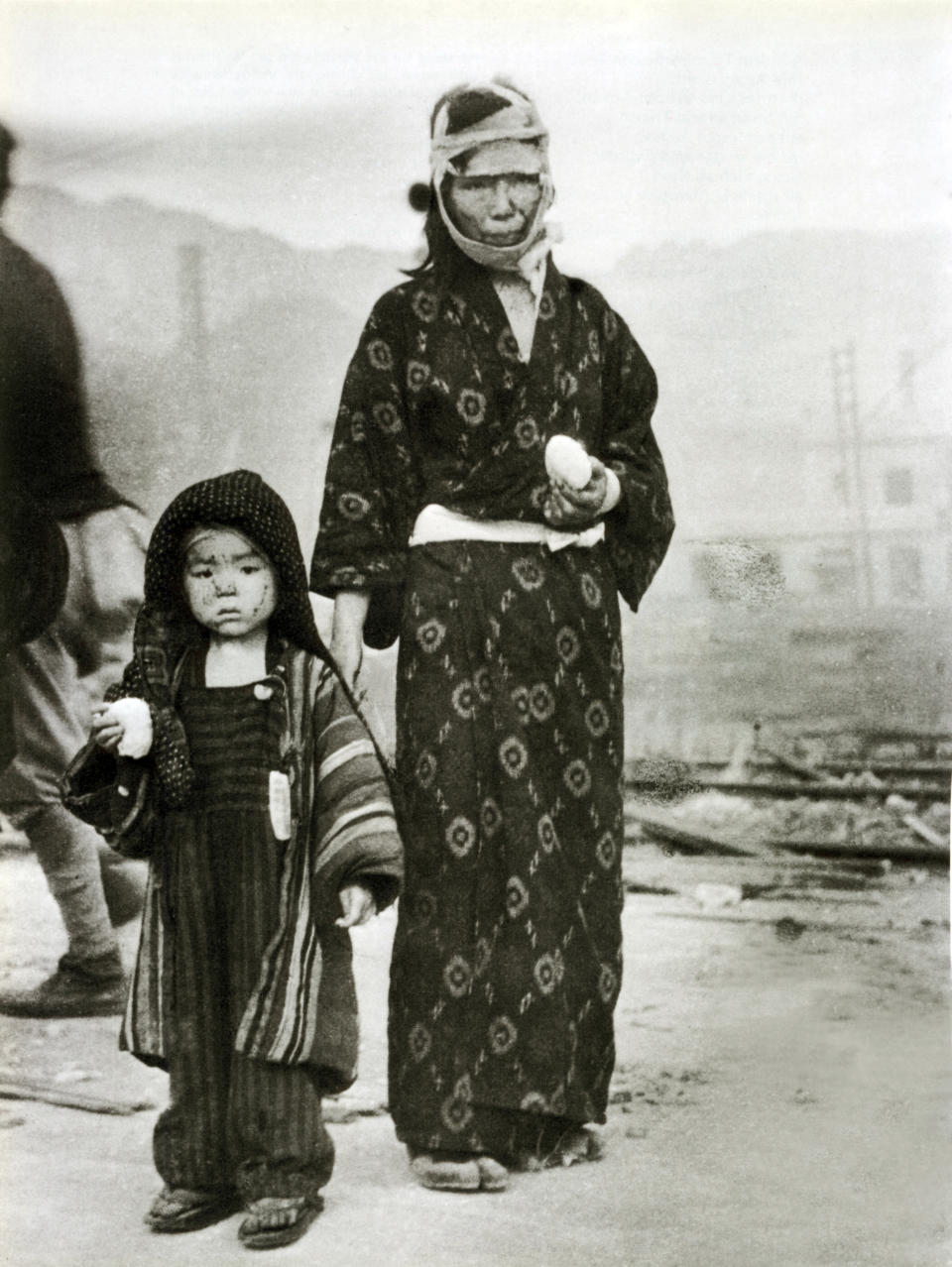 A child with her mother in Nagasaki on the morning after the dropping of the atomic bomb, Aug. 10, 1945. Both have received a rice dumpling from emergency supplies. They were 1.5 km southeast of the Epicenter. (Photo: Galerie Bilderwelt/Getty Images)