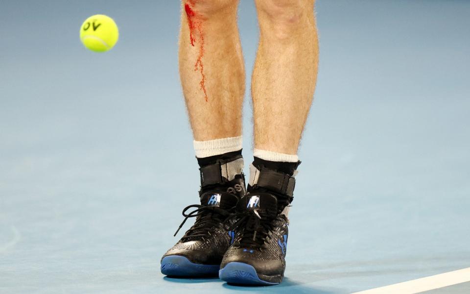 La rodilla derecha sangrante de Andy Murray durante su partido - Elementos del típico clásico de Andy Murray - y por qué tenemos que disfrutarlos mientras duren - Reuters/Hannah McKay