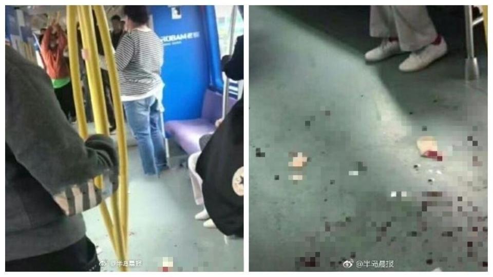 大連地鐵發生濺血事件，一名男子因為讓座給一名婦人，竟遭自己的妻子和岳父毆打。(圖／翻攝自微博)