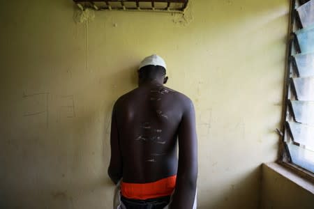 FILE PHOTO: A 14 year-old-boy, one of hundreds of men and boys rescued by police from an institution purporting to be an Islamic school, reveals scars on his back at a transit camp set up to take care of the released captives in Kaduna