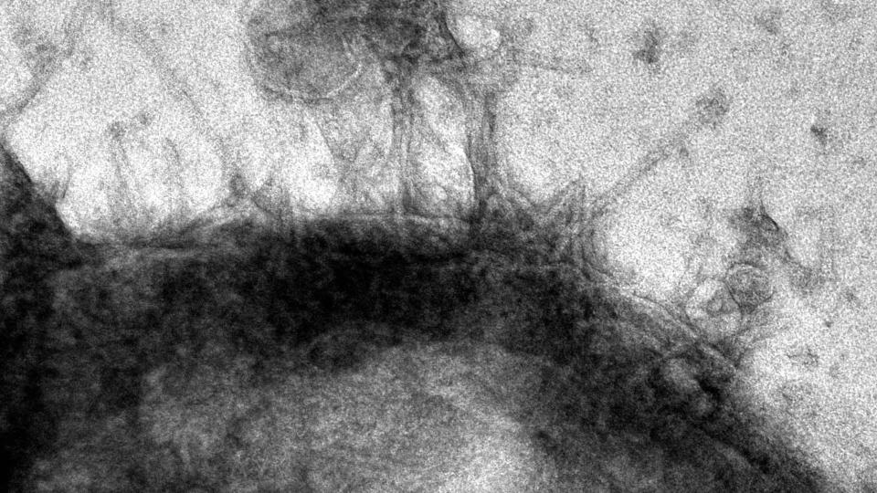 black and white microscopy image shows tube-like proteins binding to the surface of a cancer cell