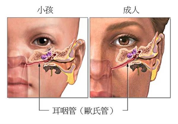 圖為小孩與大人耳咽管的不同。（圖片／溫明勳醫師提供）