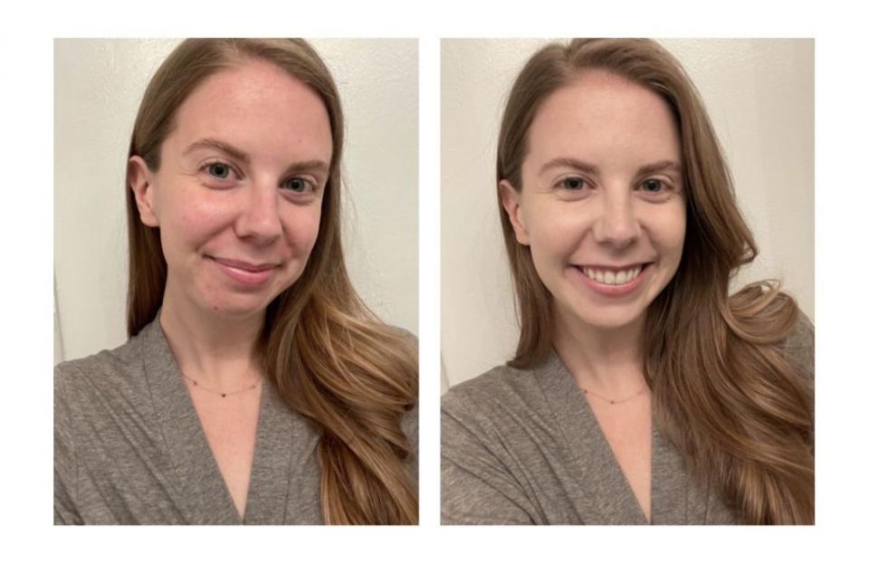 On the left, I’m makeup-free. On the right, I’m wearing only the Skin Balm in the shade 1.0.Credit: Julia Webb for In The Know