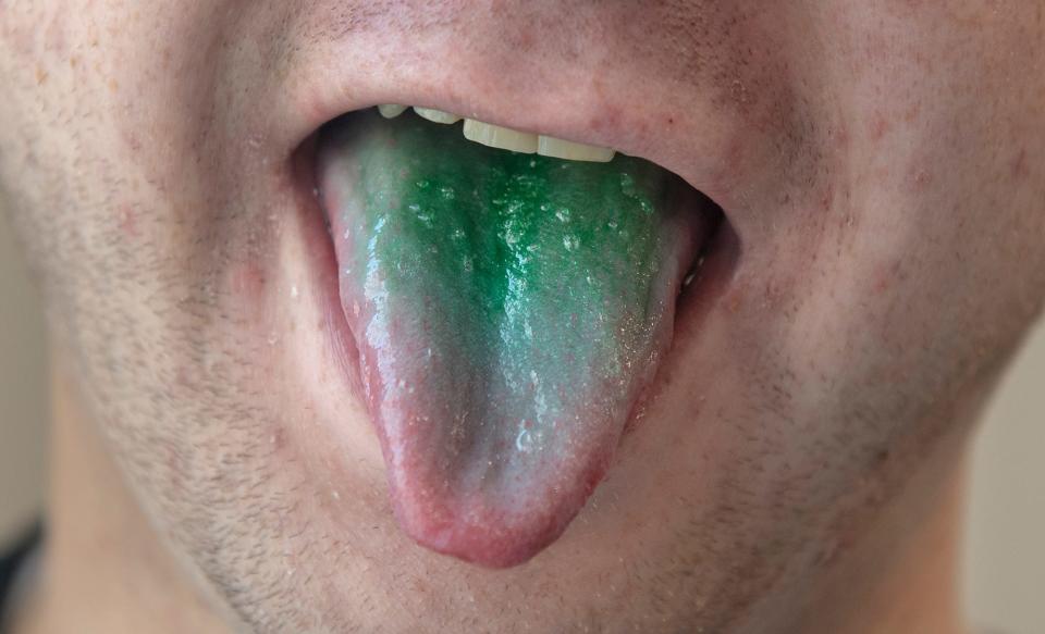 Police officers have alleged in some DUI cases that people who recently smoked marijuana had green tongues. There’s no scientific evidence that police cited that shows marijuana causes someone’s tongue to turn green.