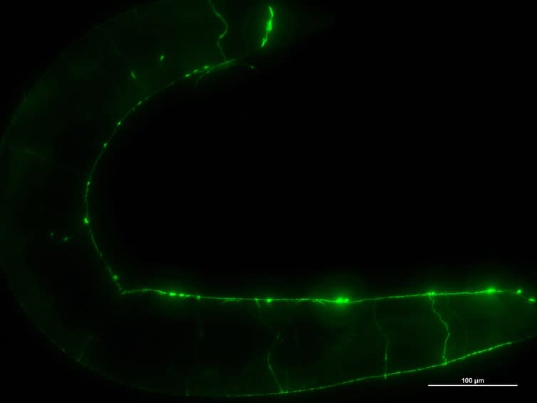 <span class="caption">Roundworm expressing green fluorescent protein in specific neurons.</span> <span class="attribution"><span class="source">Shiquan Wong, Liverpool University</span></span>