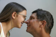 Cecilia Shaffette and her father Rhett Shaffette touch noses as they pose for a portrait in their home in Carriere, Miss., Wednesday, June 16, 2021. The 12-year-old is thriving, eight months after getting a portion of her father's liver. She received the transplant after nearly losing her life to internal bleeding. (AP Photo/Gerald Herbert)