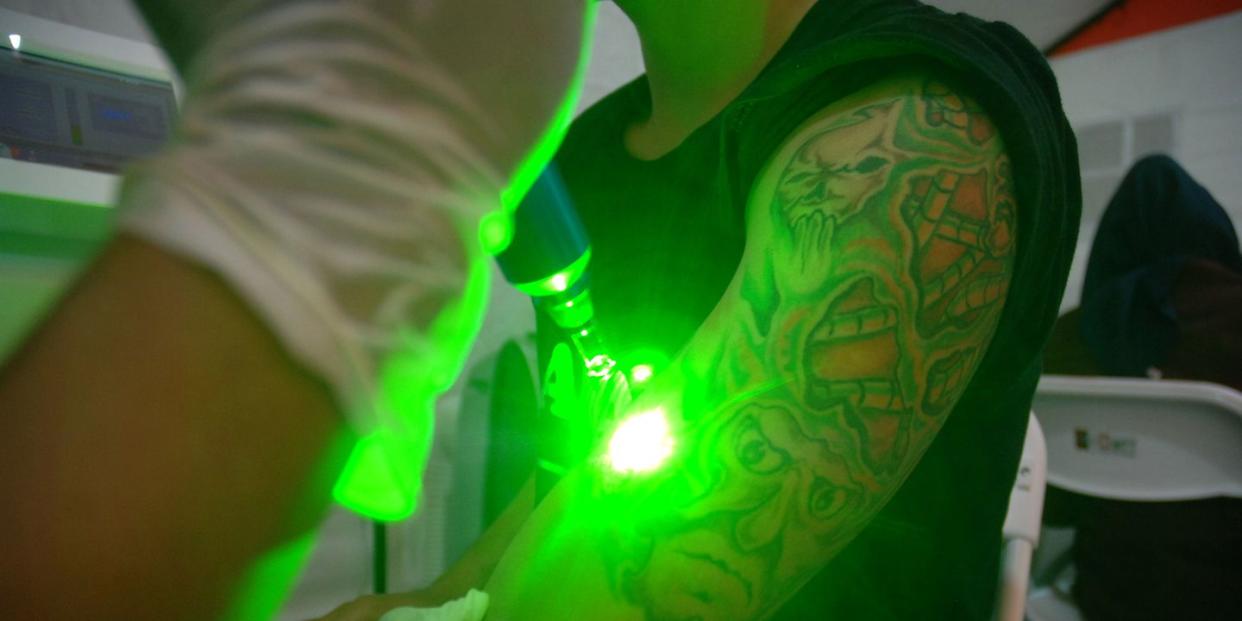 green laser shining on tattooed arm