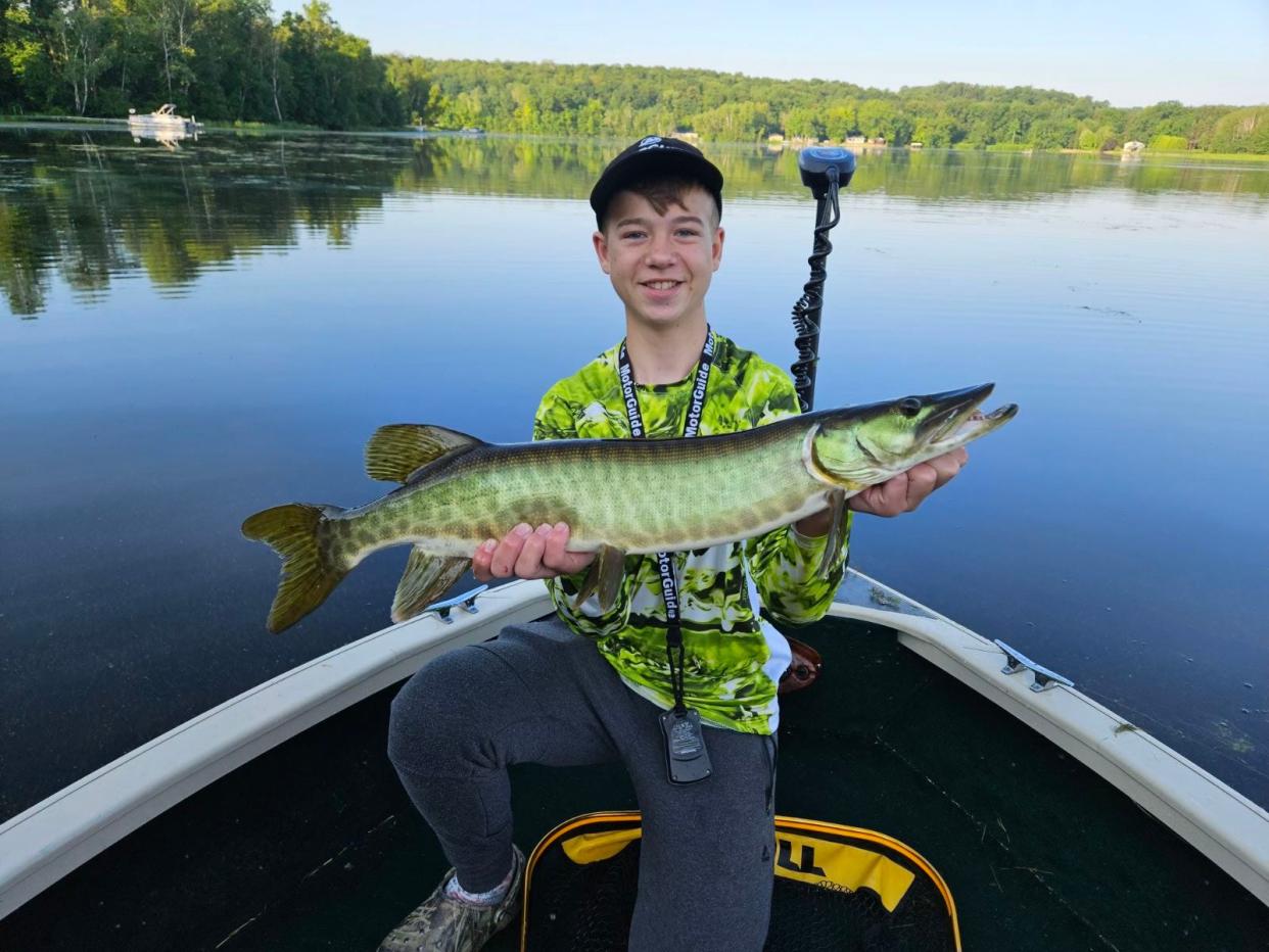 Brett Jedwabny, 15, who was involved in a power washer accident on July 9.