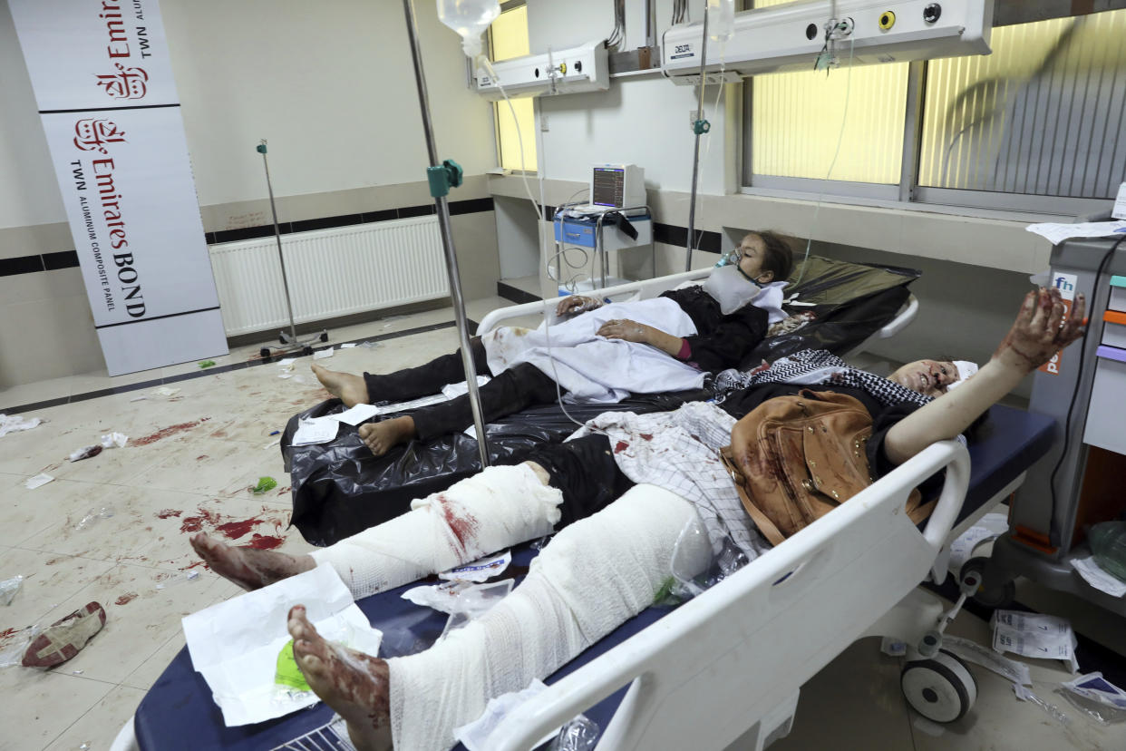 Afghan school students treated at a hospital after a bomb explosion near a school in west of Kabul, Afghanistan, Saturday, May 8, 2021. A bomb exploded near a school in west Kabul on Saturday, killing several, many them young students, Afghan government spokesmen said. (AP Photo/Rahmat Gul)
