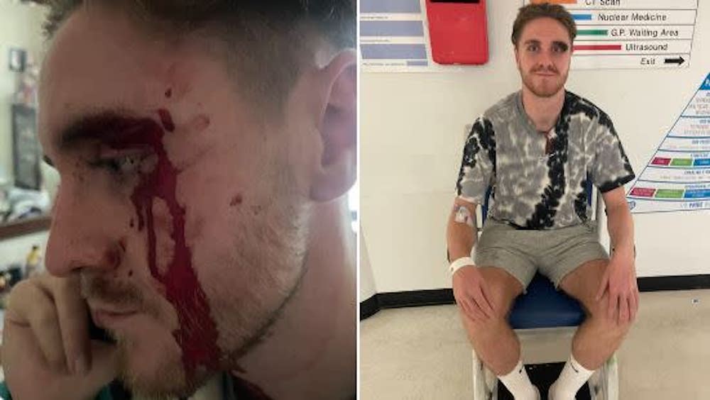 Callum Griggs was subjected to a homophobic attack in east London on Sunday. (Brad Balueta/X)