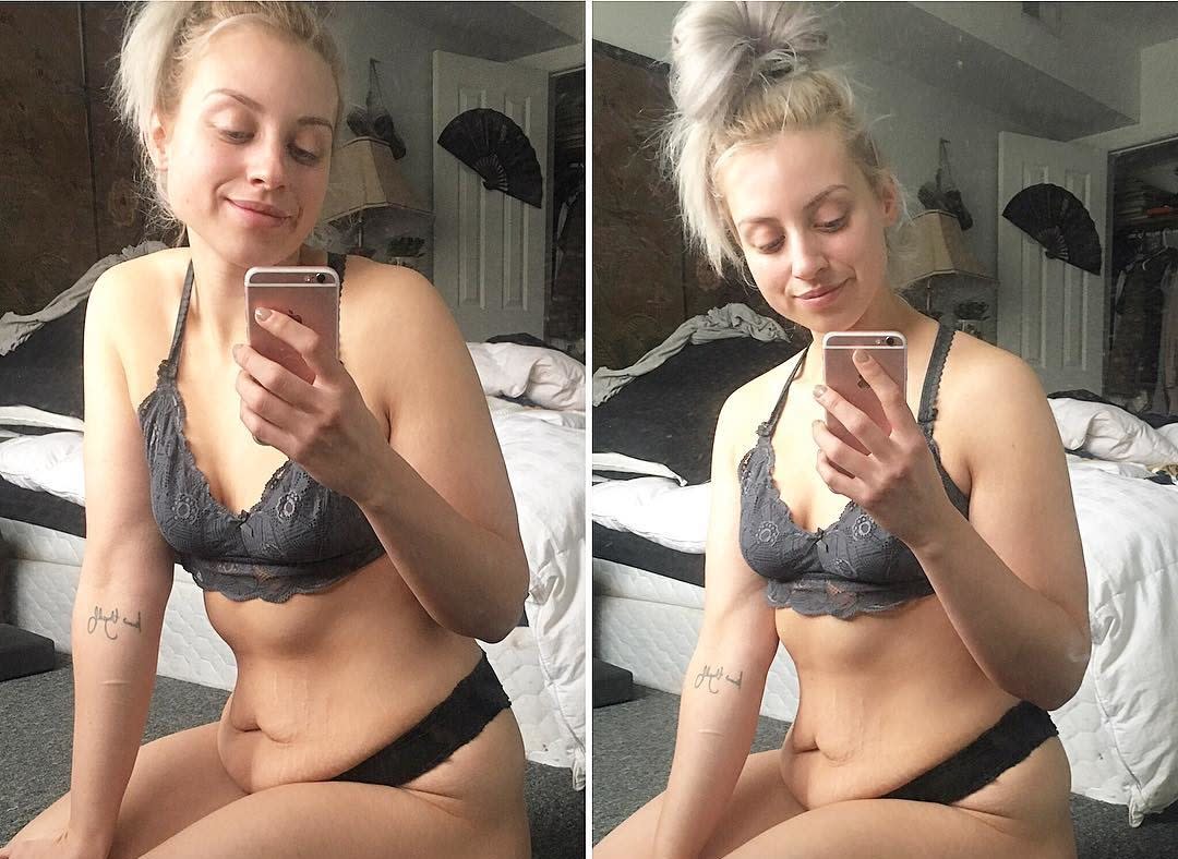 This woman lists every single thought she has about her stretch marks — but it’s not how it seems