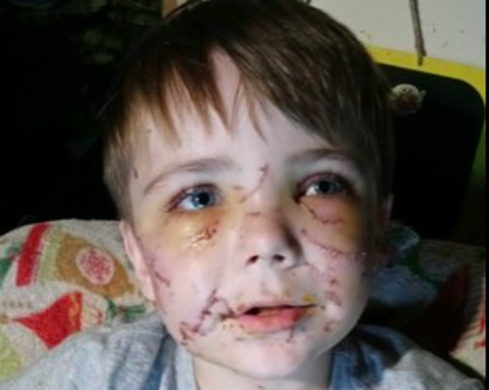 Conner Landers was mauled as he got off the school bus. (Parker County Sheriff’s office)