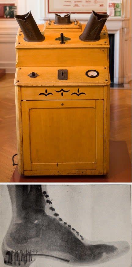 A shoe-fitting fluoroscope machine above the X-ray image of a foot in a shoe