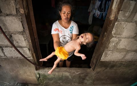 Marc Anthony Fernandes Riego, aged two, with his mother Aurora, 45. Weighing only 4kg, he is severely stunted, which has delayed his development. His mother did not have enough to eat during her pregnancy - Credit: Simon Townsley