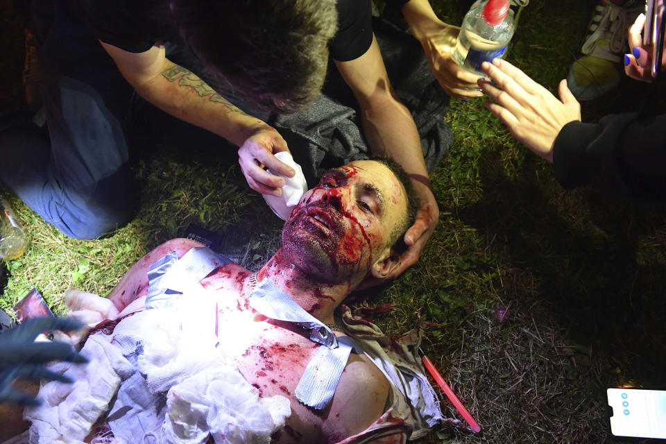 FILE - In this Sunday, Aug. 9, 2020 file photo, protesters give aid to a man injured by shrapnel from a smoke grenade during clashes with police after the presidential election in Minsk, Belarus. President Alexander Lukashenko earned the nickname of “Europe’s last dictator” in the West for his relentless repression of dissent since taking the helm in 1994. was once called “Europe’s last dictator” in the West and has ruled Belarus with an iron fist for 27 years. But when massive protests that began last August presented him with an unprecedented challenge, he responded with exceptional force. (AP Photo, File)