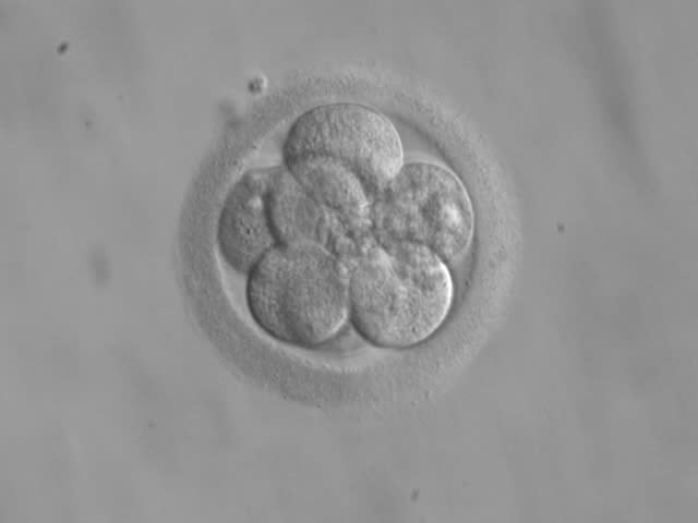 Embrión humano compuesto por 8 células. (Crédito imagen: Wikipedia).