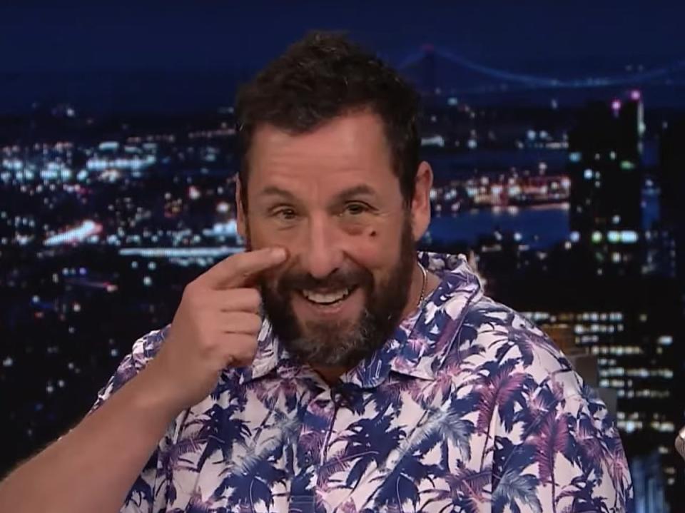 Adam Sandler on ‘The Tonight Show’, sporting a black eye (NBC)