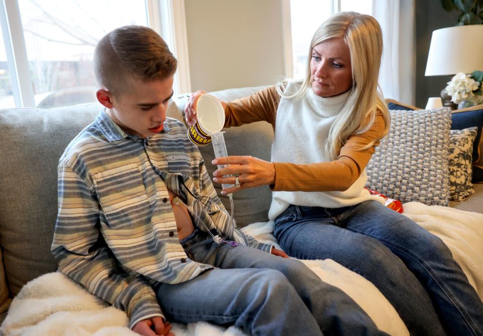 April Sintz pours water into her son Isaac’s feeding tube at home in South Jordan on Wednesday, March 22, 2023. Isaac, 16, has Dravet syndrome, a severe form of epilepsy, and uses cannabidiol to treat his seizures. | Kristin Murphy, Deseret News