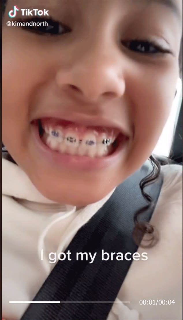 New Braces