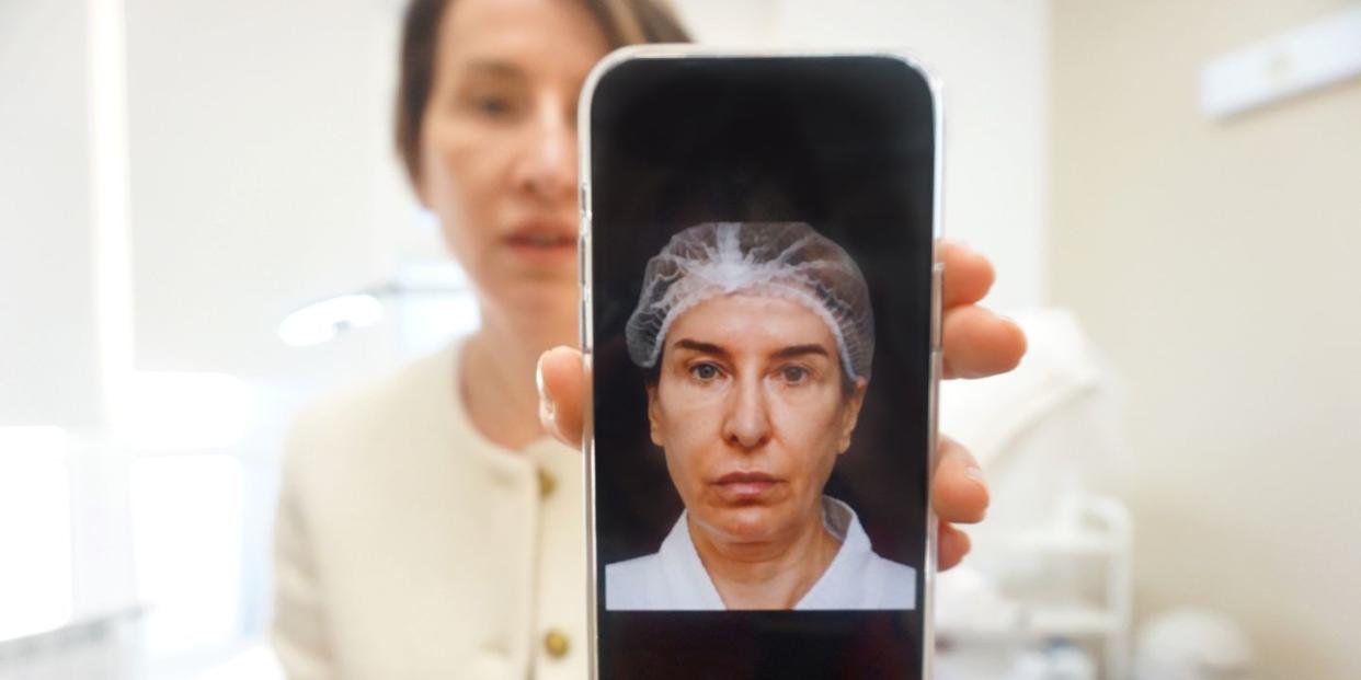 olga saienko shows a photo of her face before she got a facelift