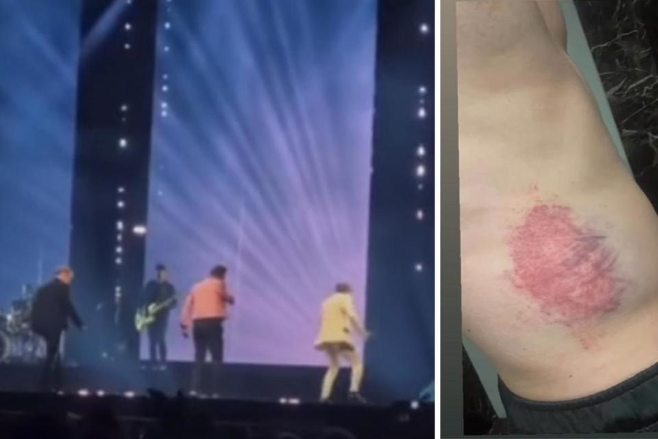 'Bit bruised' Westlife star updates fans after falling off stage in Glasgow <i>(Image: Instagram)</i>