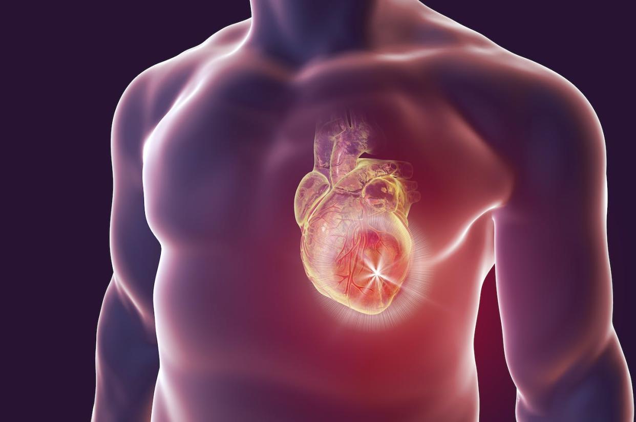 <a href="https://www.shutterstock.com/es/image-illustration/heart-attack-conceptual-image-diseases-3d-649471195" rel="nofollow noopener" target="_blank" data-ylk="slk:Shutterstock / Kateryna Kon;elm:context_link;itc:0;sec:content-canvas" class="link ">Shutterstock / Kateryna Kon</a>