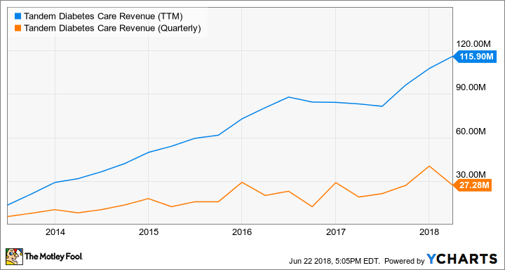 TNDM Revenue (TTM) Chart
