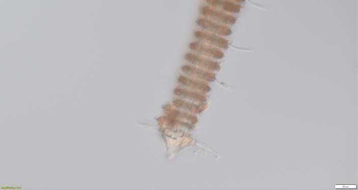 Imagen microscópica del nematodo tricoma.