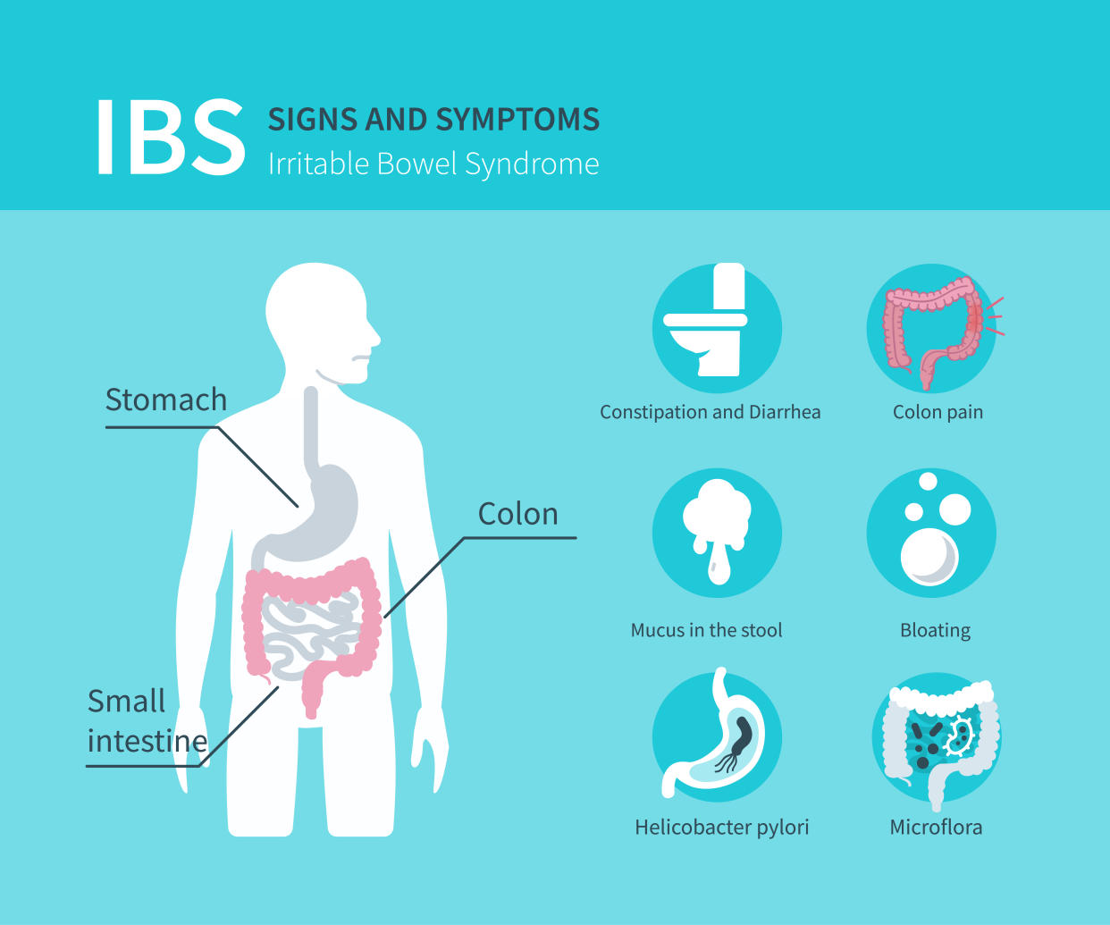 Irritable bowel syndrome concept design for web banners, infographics. IBS signs and symptoms set. Flat style vector illustration.