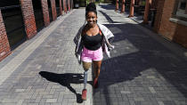 Claudine Humure, of Rwanda, walks with her new prosthetic leg at Next Step Bionics & Prosthetics, Monday, Sept. 20, 2021, in Newton, Mass. Humure was orphaned during her country's genocide and lost part of her leg to childhood cancer. Her new leg was provided free by the prosthetic clinic and features the latest in artificial limb technology. (AP Photo/Charles Krupa)