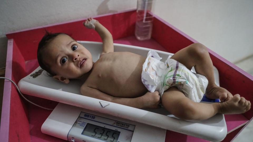 Eine Krankenschwester ermittelt das Gewicht eines unterernährten Kindes im Ibn Sina Krankenhaus in Idlib. Das Welternährungsprogramm (WFP) geht von 270 Millionen Menschen aus, die in 2021 akut an Hunger leiden oder davon stark gefährdet sein werden.