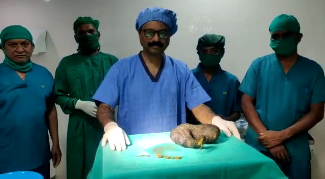 Doctors stand with the ball of hair weighing over 1kg. Source: Jam Press/ Australscope