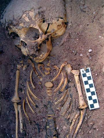 Close-up of upper body of burial 519, the 2,000-year-old remains of the abused toddler in Egypt.