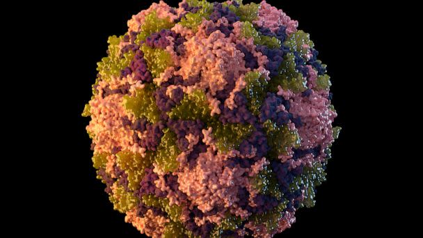 PHOTO: This 2014 illustration made available by the U.S. Centers for Disease Control and Prevention depicts a polio virus particle. On Thursday, July 21, 2022, New York health officials reported a polio case, the first in the U.S. in nearly a decade.  (Sarah Poser, Meredith Boyter Newlove/CDC via AP)