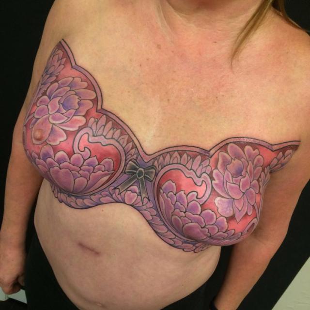wow how incredible!!!! tattoo of a lace bra on a woman who had a double  mastectomy after implants..very - Illinois Mastectomy fitter (breast  prosthesis for breast cancer survivors)
