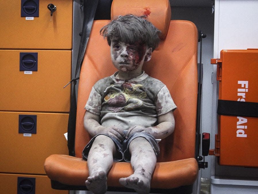 The 5-year-old Syrian child Omran Daqneesh.