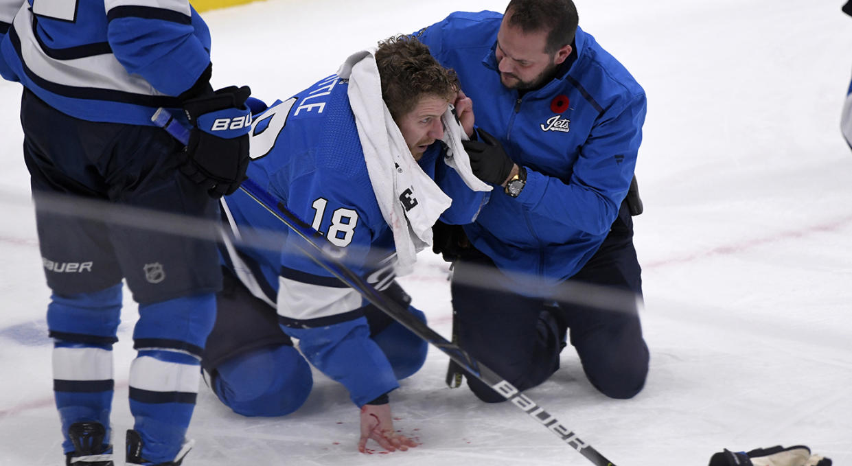 Winnipeg Jets' Bryan Little (18) is helped after getting hit in the head with the puck against the New Jersey Devils during the third period of an NHL hockey game, Tuesday, Nov. 5, 2019 in Winnipeg, Manitoba. (Fred Greenslade/Canadian Press via AP)