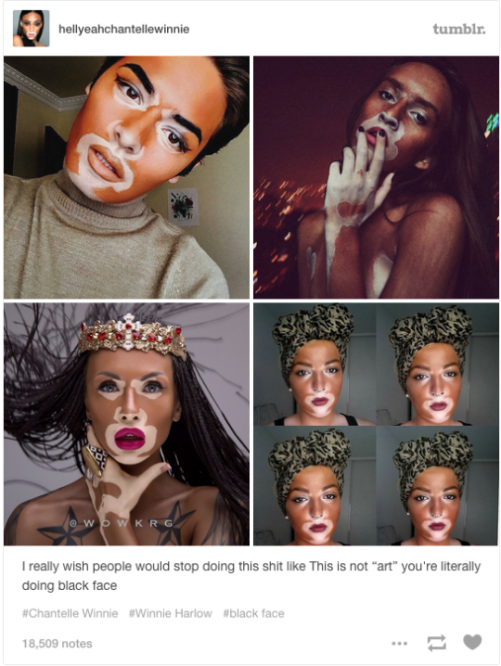 vitiligo models tumblr