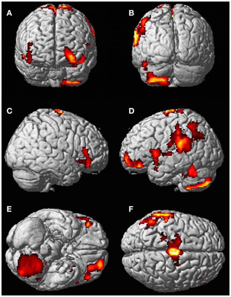 brain scan activated areas