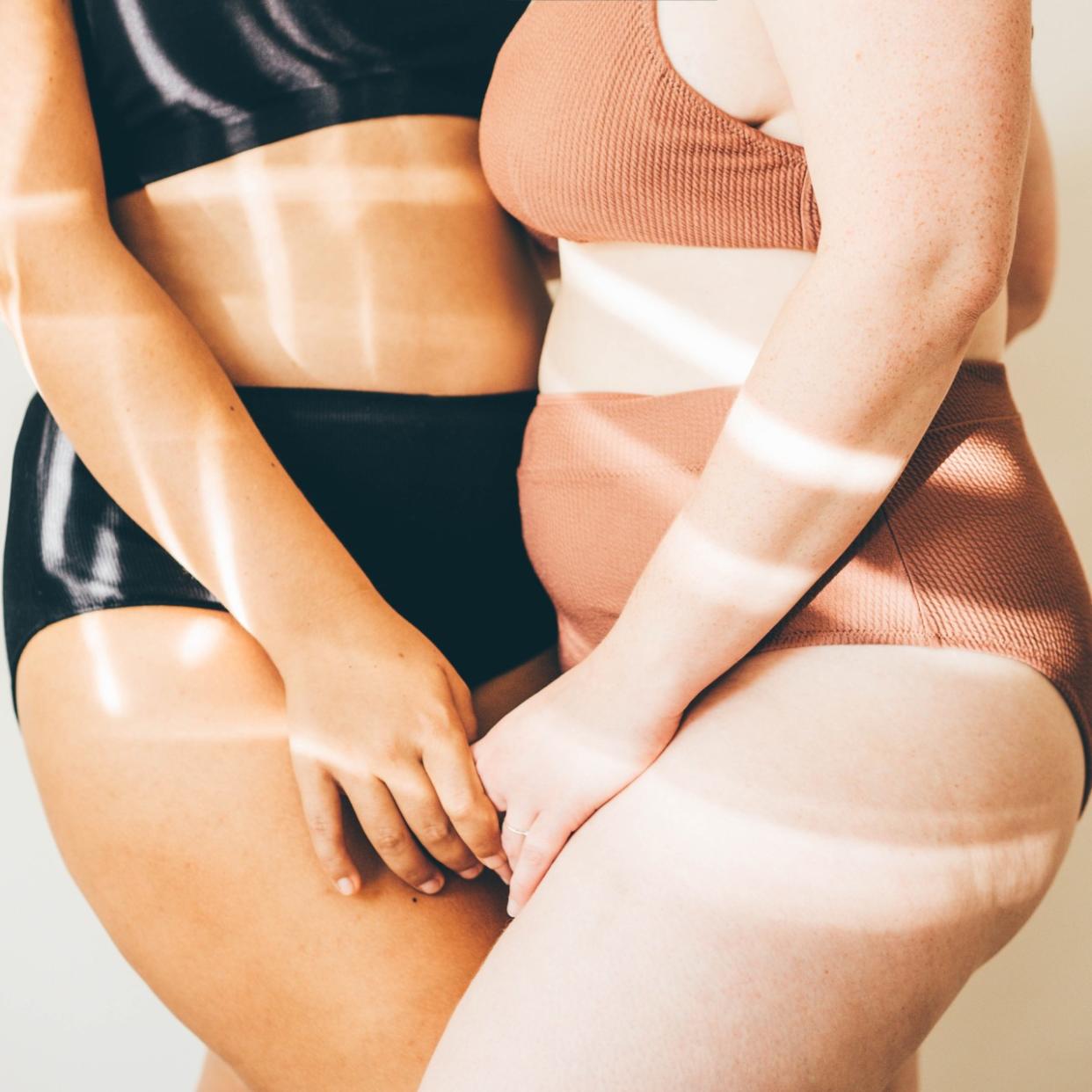  Two women with cellulite. 
