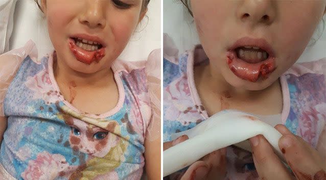 Zoe's mum said she was knocked to the ground and bitten by the dog. Source: Supplied