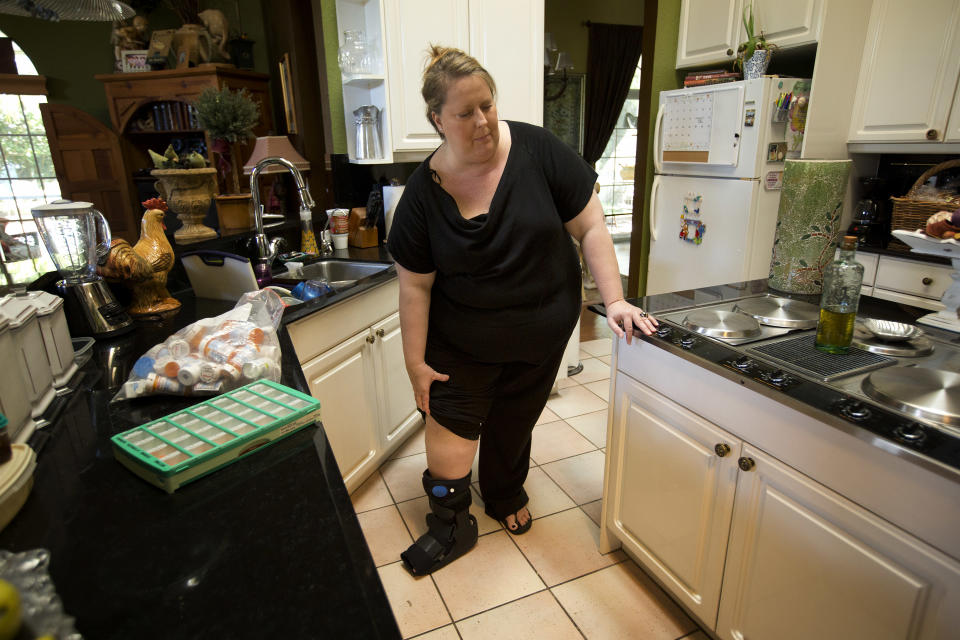 In this Monday, Oct 22, 2012 photo, Julie Susi stops to check her leg, the one with a broken bone, in her Davie, Fla. home as she talks about her father and the upcoming auction. Susi suffers from a rare autoimmune disease that makes her bones dangerously brittle and causes her body’s defenses to attack her own blood vessels. Her father, Ken Kallin, hopes to sell off his entire 120,000-piece memorabilia collection that includes photographs signed by Muhammad Ali and Neil Armstrong at an auction to benefit Julie.  (AP Photo/J Pat Carter)