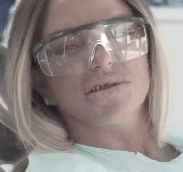 Katie Price in the dentist's chair without veneers