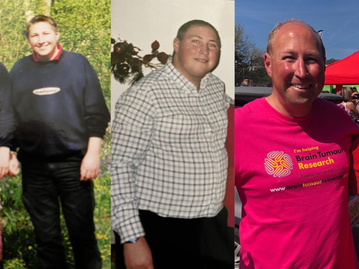Jonathan Plummer before, during and after treatment for a brain tumor
